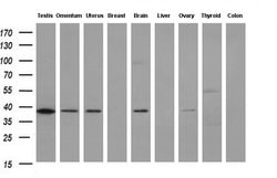 Invitrogen HSP40 Monoclonal Antibody (OTI1E9) 100 &mu;L; Unconjugated:Antibodies,