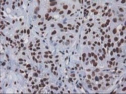 Invitrogen CTDSP1 Monoclonal Antibody (OTI1B6) 100 &mu;L; Unconjugated:Antibodies,