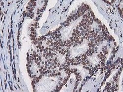 Invitrogen CTDSP1 Monoclonal Antibody (OTI1B6) 100 &mu;L; Unconjugated:Antibodies,