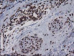 Invitrogen CTDSP1 Monoclonal Antibody (OTI1B6) 100 &mu;L; Unconjugated:Antibodies,