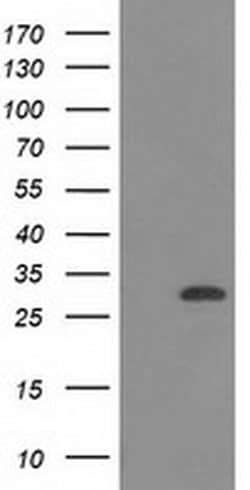 Invitrogen CTDSP1 Monoclonal Antibody (OTI1B6) 100 &mu;L; Unconjugated:Antibodies,
