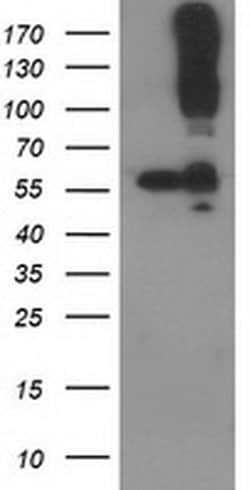 Invitrogen CDCP1 Monoclonal Antibody (OTI2C1) 100 &mu;L; Unconjugated:Antibodies,