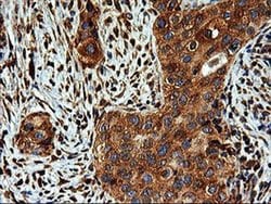 Invitrogen LMAN1 Monoclonal Antibody (OTI1C5) 100 &mu;L; Unconjugated:Antibodies,