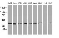 Invitrogen HSP40 Monoclonal Antibody (OTI1G4) 100 &mu;L | Buy Online | Invitrogen&trade; | Fisher Scientific