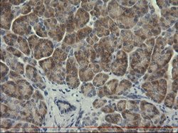 Invitrogen SERPINB3 Monoclonal Antibody (OTI3C2) 100 &mu;L; Unconjugated:Antibodies,