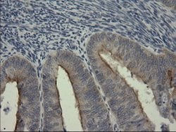 Invitrogen SERPINB3 Monoclonal Antibody (OTI3C2) 100 &mu;L; Unconjugated:Antibodies,