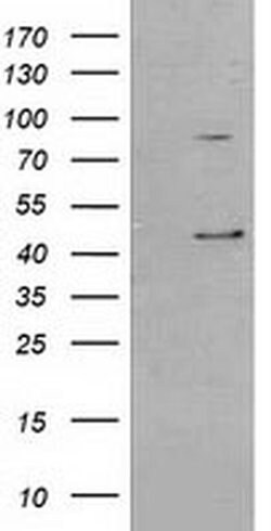 Invitrogen SERPINB3 Monoclonal Antibody (OTI3C2) 100 &mu;L; Unconjugated:Antibodies,