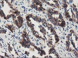 Invitrogen MMAB Monoclonal Antibody (OTI5G1) 100 &mu;L; Unconjugated:Antibodies,