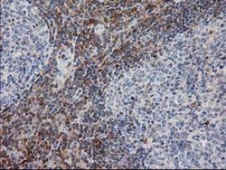 Invitrogen PIP4K2A Monoclonal Antibody (OTI3D3) 100 &mu;L; Unconjugated:Antibodies,