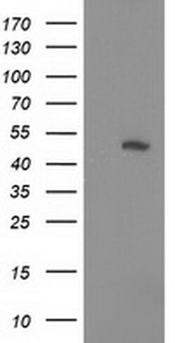 Invitrogen PIP4K2A Monoclonal Antibody (OTI3D3) 100 &mu;L; Unconjugated:Antibodies,