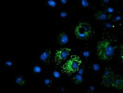 Invitrogen MMAA Monoclonal Antibody (OTI3G5) 100 &mu;L; Unconjugated:Antibodies,