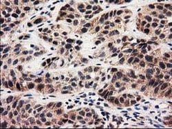 Invitrogen MMAA Monoclonal Antibody (OTI3G5) 100 &mu;L; Unconjugated:Antibodies,