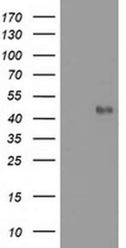 Invitrogen MMAA Monoclonal Antibody (OTI3G5) 100 &mu;L; Unconjugated:Antibodies,