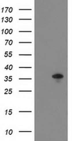 Invitrogen ACY3 Monoclonal Antibody (OTI2G4) 100 &mu;L; Unconjugated:Antibodies,