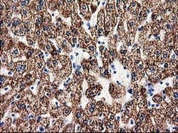 Invitrogen ACY3 Monoclonal Antibody (OTI4C1) 100 &mu;L; Unconjugated:Antibodies,