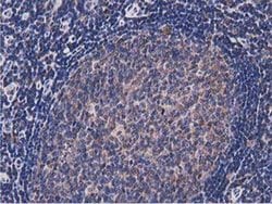NUDT6 Monoclonal Antibody (OTI9D12):Antibodies, Monoclonal