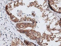 NUDT6 Monoclonal Antibody (OTI9D12):Antibodies, Monoclonal