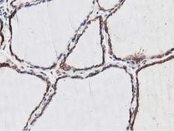 NUDT6 Monoclonal Antibody (OTI9D12):Antibodies, Monoclonal