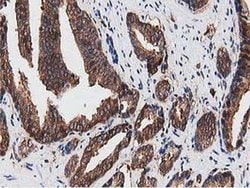 NUDT6 Monoclonal Antibody (OTI9D12):Antibodies, Monoclonal
