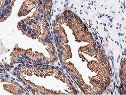 NUDT6 Monoclonal Antibody (OTI9D12):Antibodies, Monoclonal