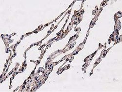 NUDT6 Monoclonal Antibody (OTI9D12):Antibodies, Monoclonal