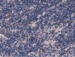 NUDT6 Monoclonal Antibody (OTI9D12):Antibodies, Monoclonal