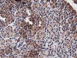 NUDT6 Monoclonal Antibody (OTI9D12):Antibodies, Monoclonal