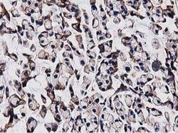 Invitrogen OGFOD1 Monoclonal Antibody (OTI1F4) 100 &mu;L; Unconjugated:Antibodies,