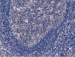 Invitrogen OGFOD1 Monoclonal Antibody (OTI1F4) 100 &mu;L; Unconjugated:Antibodies,