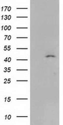 Invitrogen SERPINB4 Monoclonal Antibody (OTI4C8) 100 &mu;L; Unconjugated:Antibodies,
