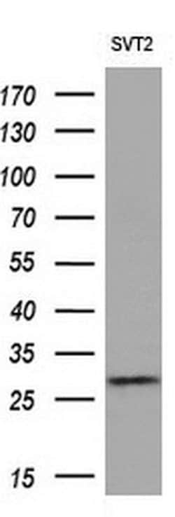 Invitrogen eIF4E2 Monoclonal Antibody (OTI1F11) 100 &mu;L; Unconjugated:Antibodies,