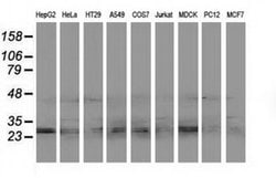 Invitrogen eIF4E2 Monoclonal Antibody (OTI1C1) 100 &mu;L; Unconjugated:Antibodies,
