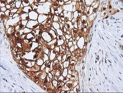 Invitrogen SERPINB4 Monoclonal Antibody (OTI4C10) 100 &mu;L; Unconjugated:Antibodies,