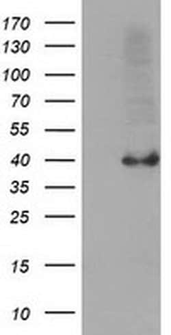 Invitrogen SERPINB4 Monoclonal Antibody (OTI4C10) 100 &mu;L; Unconjugated:Antibodies,