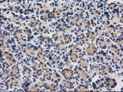 Invitrogen CTH Monoclonal Antibody (OTI2D6) 100 &mu;L | Buy Online | Invitrogen&trade; | Fisher Scientific