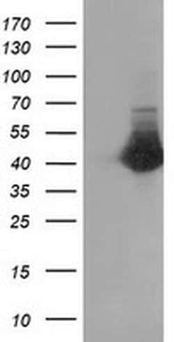 Invitrogen CTH Monoclonal Antibody (OTI2D6) 100 &mu;L | Buy Online | Invitrogen&trade; | Fisher Scientific
