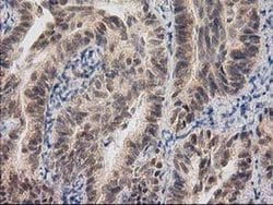 Invitrogen RASSF1 Monoclonal Antibody (OTI2B11) 100 &mu;L; Unconjugated:Antibodies,