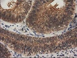Invitrogen RASSF1 Monoclonal Antibody (OTI2B11) 100 &mu;L; Unconjugated:Antibodies,