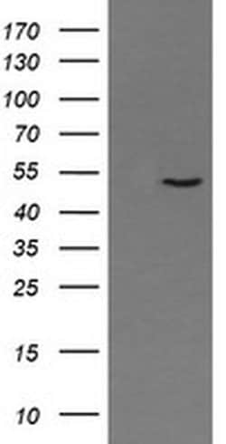Invitrogen PNMA3 Monoclonal Antibody (OTI2E6) 100 &mu;L | Buy Online | Invitrogen&trade; | Fisher Scientific
