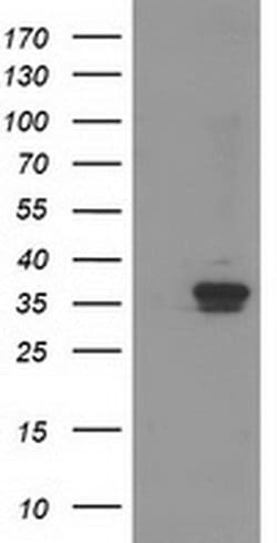 Invitrogen RDH14 Monoclonal Antibody (OTI1A7) 100 &mu;L; Unconjugated:Antibodies,