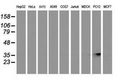 Invitrogen RDH14 Monoclonal Antibody (OTI1A7) 100 &mu;L; Unconjugated:Antibodies,