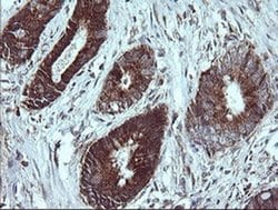 Invitrogen NDUFB9 Monoclonal Antibody (OTI3A1) 100 &mu;L; Unconjugated:Antibodies,