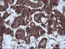 Invitrogen NDUFB9 Monoclonal Antibody (OTI3A1) 100 &mu;L; Unconjugated:Antibodies,
