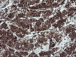Invitrogen NDUFB9 Monoclonal Antibody (OTI3A1) 100 &mu;L; Unconjugated:Antibodies,