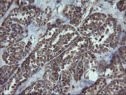 Invitrogen NDUFB9 Monoclonal Antibody (OTI3A1) 100 &mu;L; Unconjugated:Antibodies,