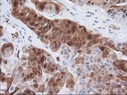 Invitrogen 15-PGDH Monoclonal Antibody (OTI2F5) 100 &mu;L; Unconjugated:Antibodies,