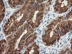 Invitrogen 15-PGDH Monoclonal Antibody (OTI2F5) 100 &mu;L; Unconjugated:Antibodies,