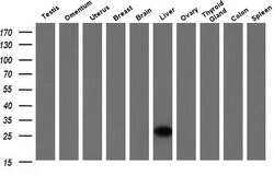 Invitrogen 15-PGDH Monoclonal Antibody (OTI2F5) 100 &mu;L; Unconjugated:Antibodies,