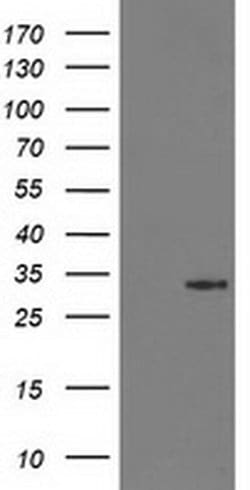 Invitrogen 15-PGDH Monoclonal Antibody (OTI2F5) 100 &mu;L; Unconjugated:Antibodies,