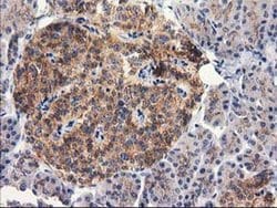 Invitrogen RTN4IP1 Monoclonal Antibody (OTI3B2) 100 &mu;L; Unconjugated:Antibodies,
